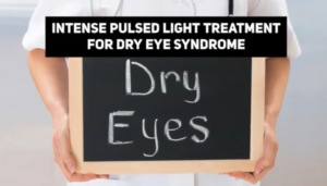 intense pulsed light ipl treatment to alleviate dry eye syndrome 5e95b02ec4649