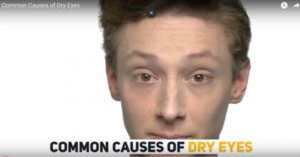 what causes dry eyes 5e95b0142fca1