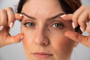 Close up of woman's eyes as she holds eyelids open from ptosis in Loveland, CO